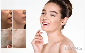 Buy Scarlet X Package - Get 1 Cosmetic Injection Free